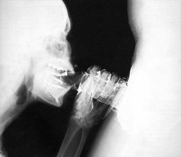 GALERIA3 - x-ray.jpg