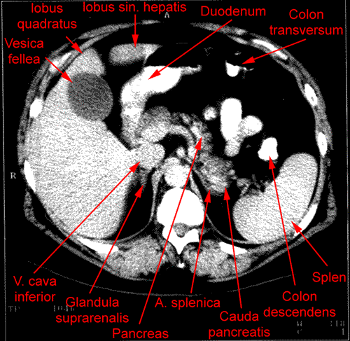 anatomia radiologiczna - 5.gif