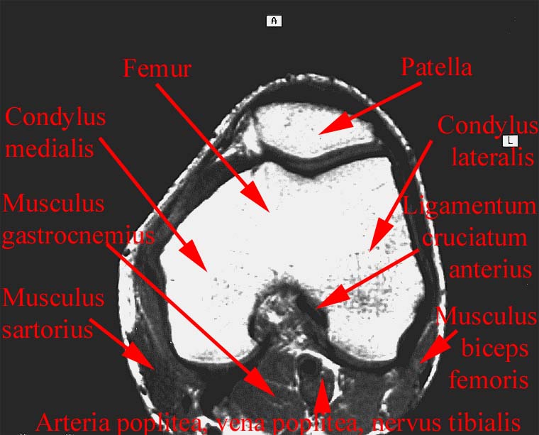 anatomia radiologiczna - 91.jpg